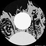 TID657965804