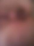 Private Photo