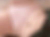 Private Photo