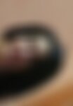 Private Photo