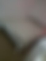 Private Photo