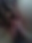 Private Photo