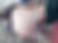 Private Photo