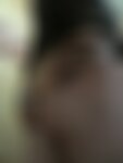 Private Photo