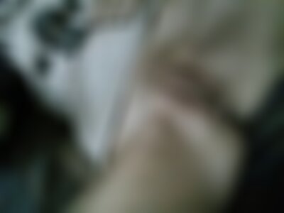 Private Photo