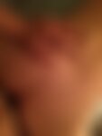 Private Photo