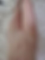 Private Photo