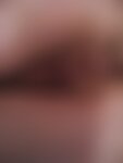 Private Photo
