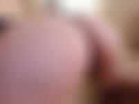 Private Photo