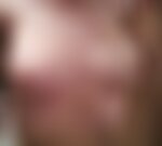 Private Photo